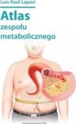 Изображение Atlas zespołu metabolicznego