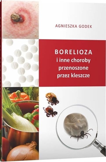 Изображение Borelioza i inne choroby przenoszone przez...