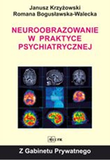 Изображение Neuroobrazowanie w praktyce psychiatrycznej