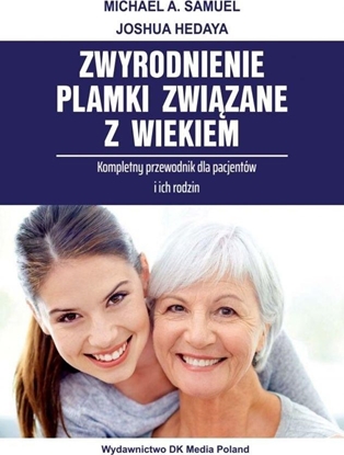 Изображение Zwyrodnienie plamki związane z wiekiem